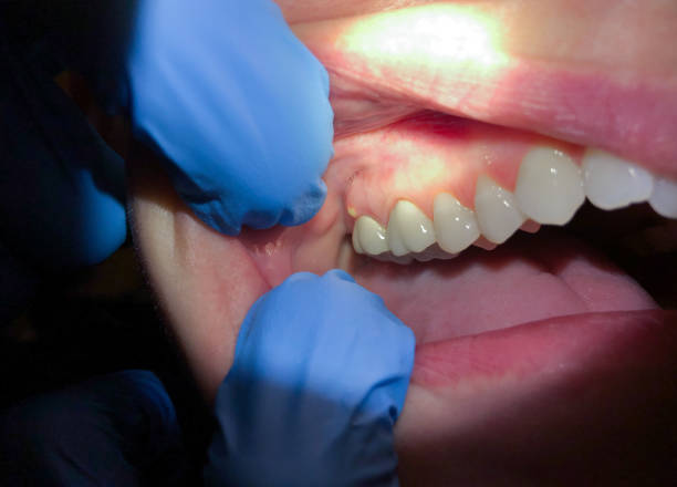 Best Pediatric Emergency Dentist in Patterson, LA